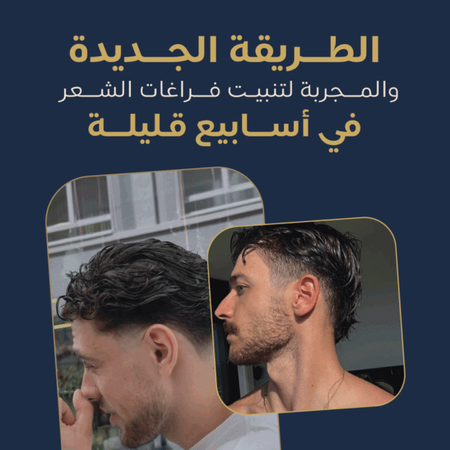 الديرما ستامب - Derma stamp